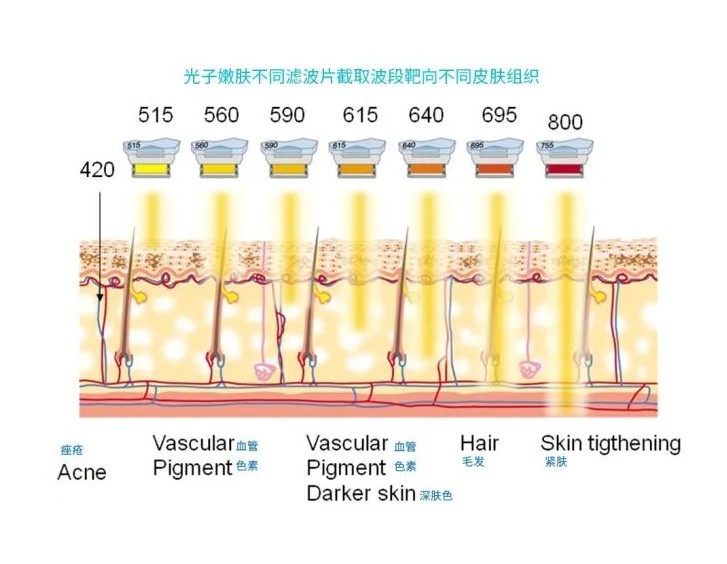 五大光子嫩膚技術(shù)（IPL、DPL、OPT、APT、BBL）及濾光片區(qū)別